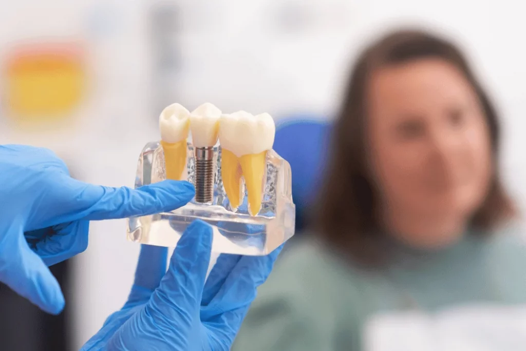 Dental Crowns and Bridges