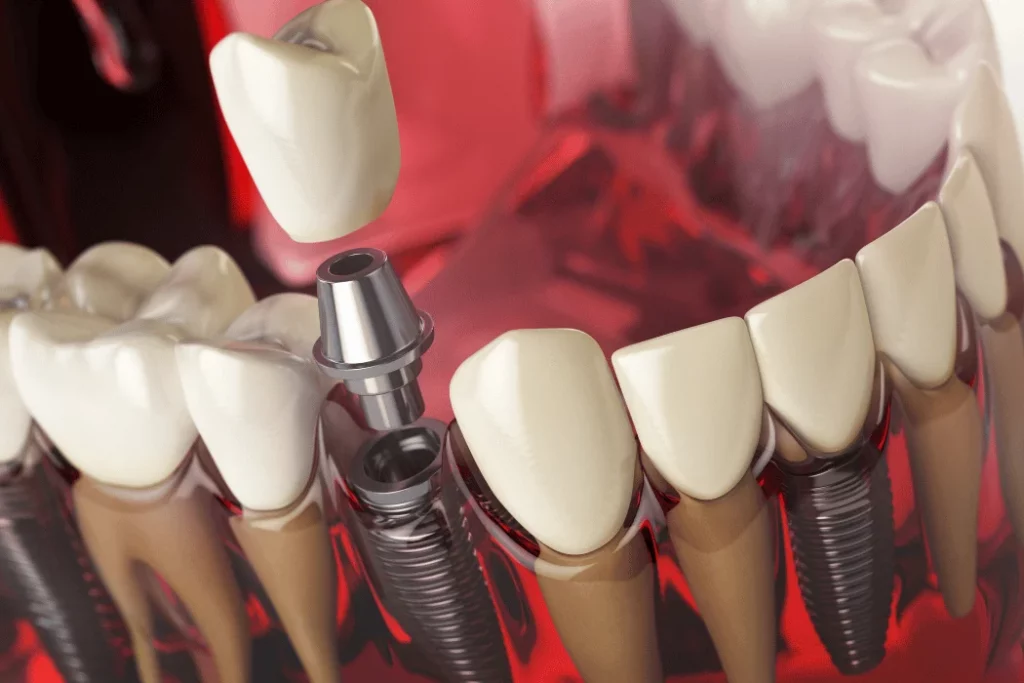 emergency dentist ventura california