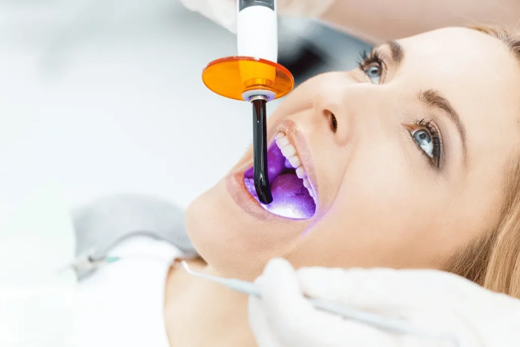 dental sealants ventura ca