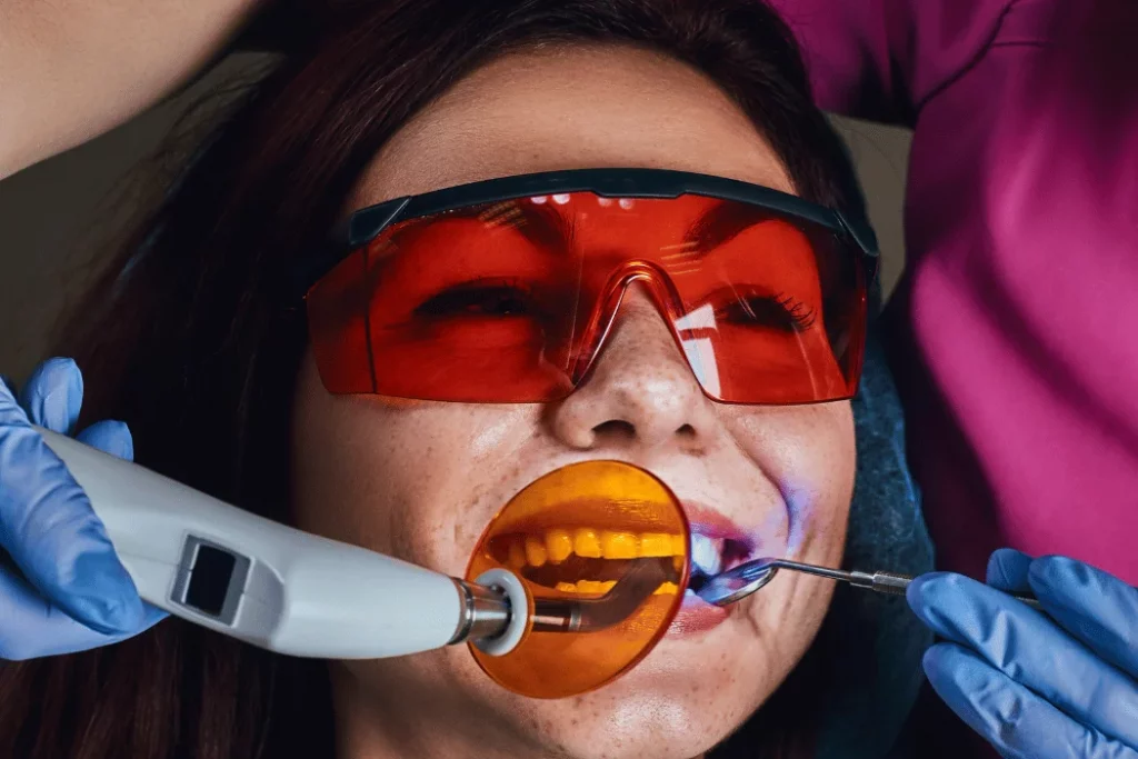 Dental bonding