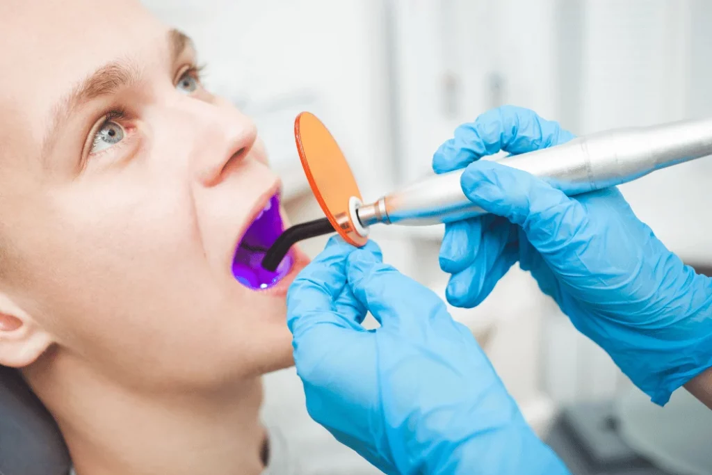 Dental sealant