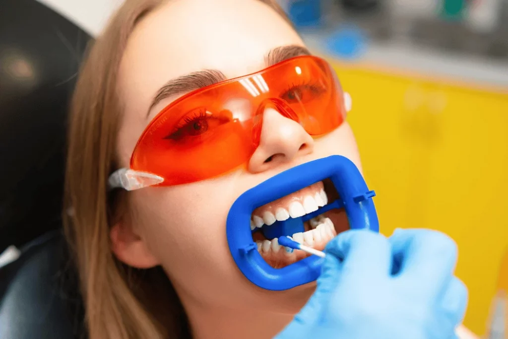 professional teeth whitening ventura