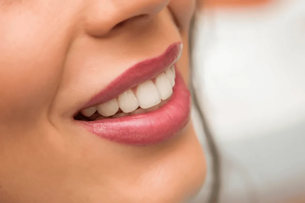 Smile Design in ventura