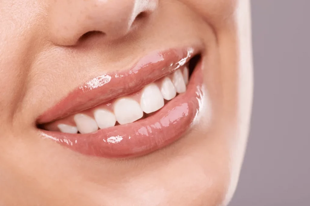 Teeth Whitening ventura ca