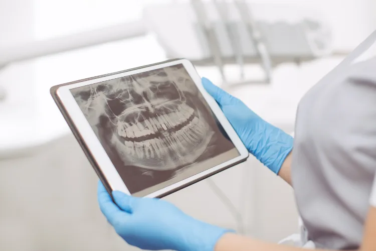 Comprehensive Dental Exam X-Rays