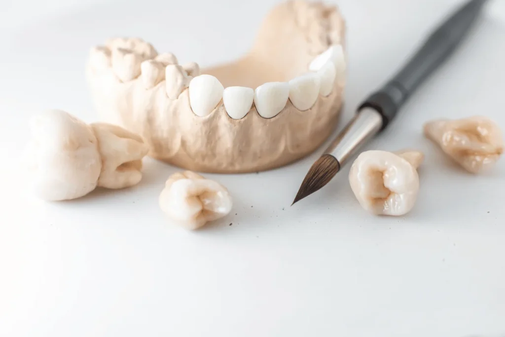 Dental crowns and bridge