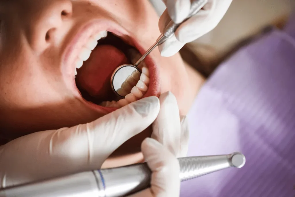 Regular cleanings with ultrasonic scaling