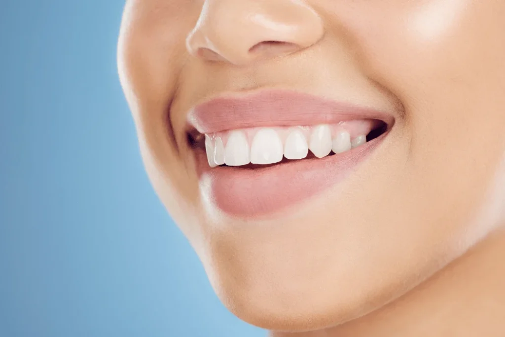 Teeth whitening