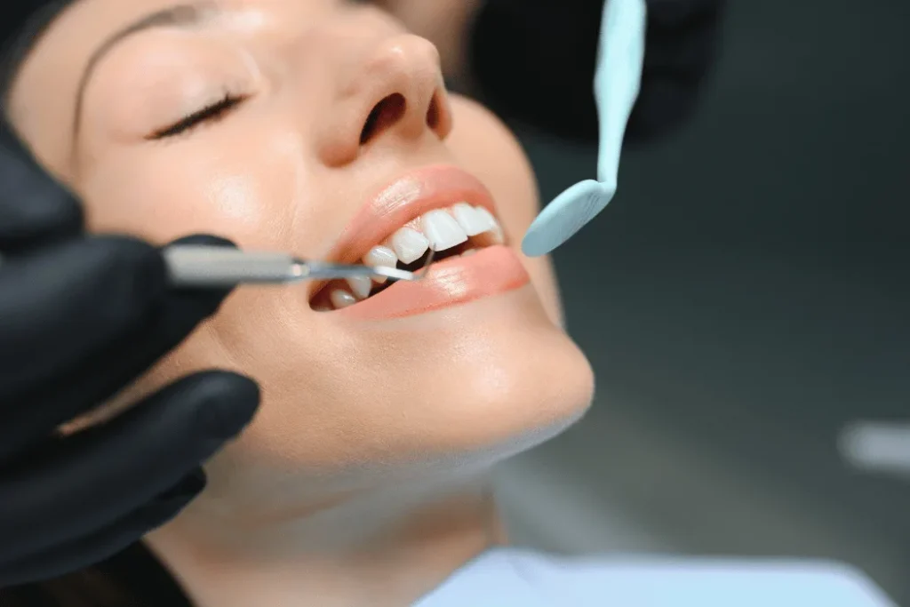 Tooth-Colored Composite Fillings